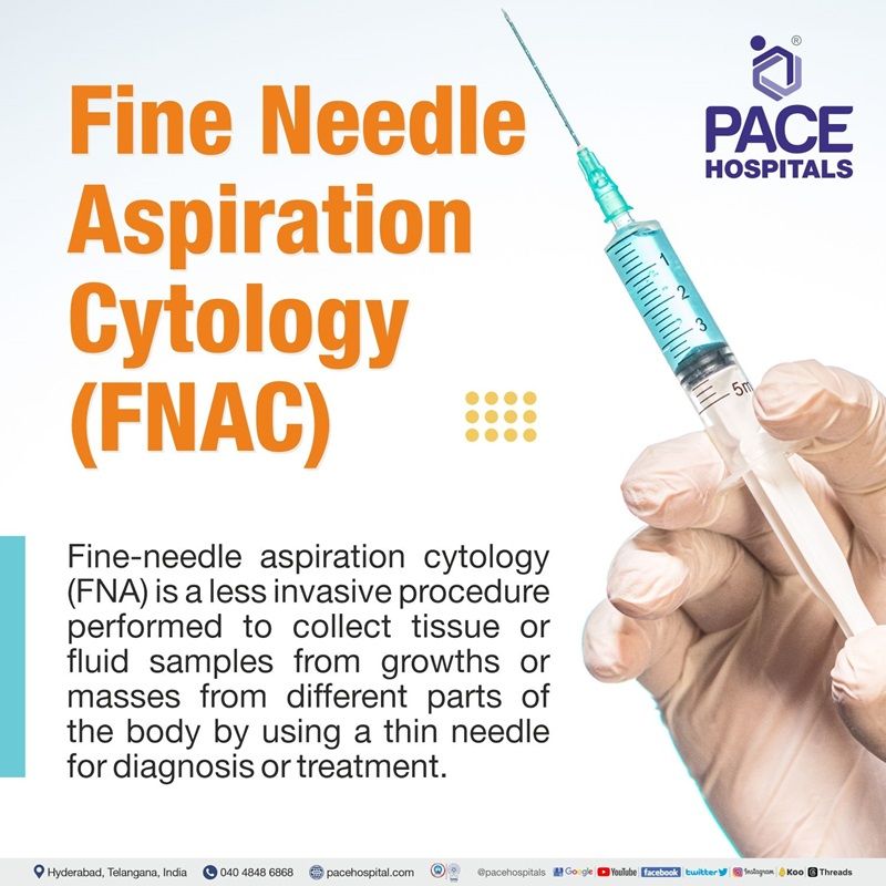 What is FNAC test Best hospital for FNAC test in Hyderabad | Best doctor for FNAC test in India | FNAC test cost | FNAC test near me