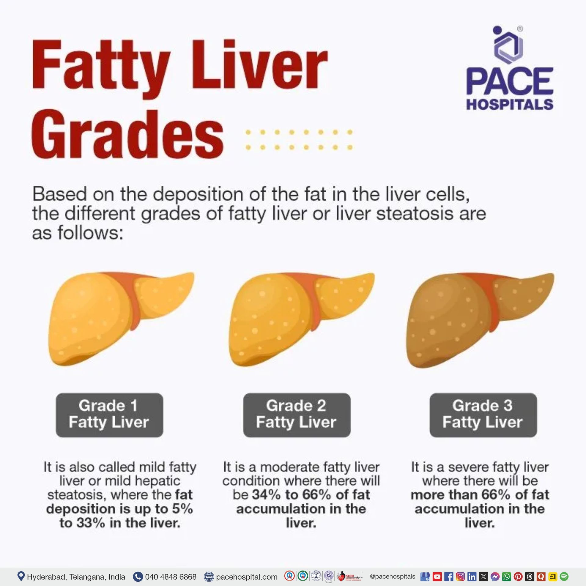 fatty liver grades explained | fatty liver grade 1 meaning | fatty liver grade 2 means | fatty liver grade 3 with hepatomegaly