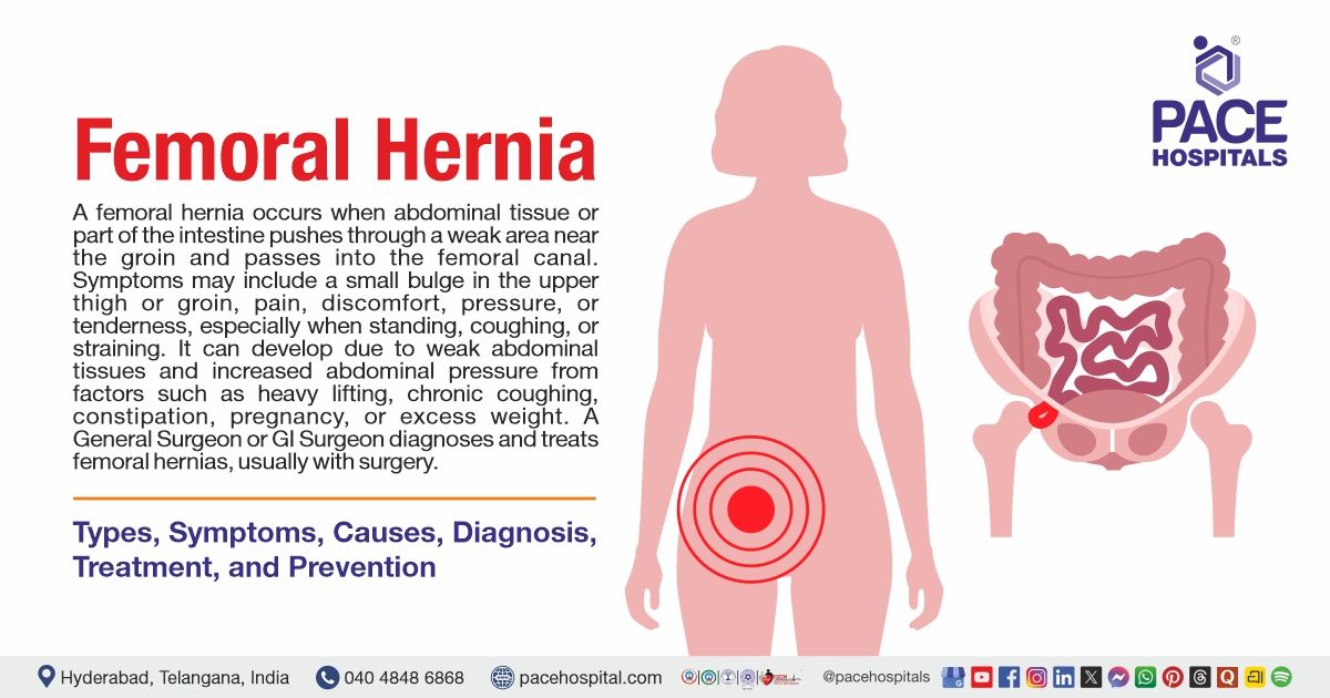 Femoral hernia symptoms, causes and treatment