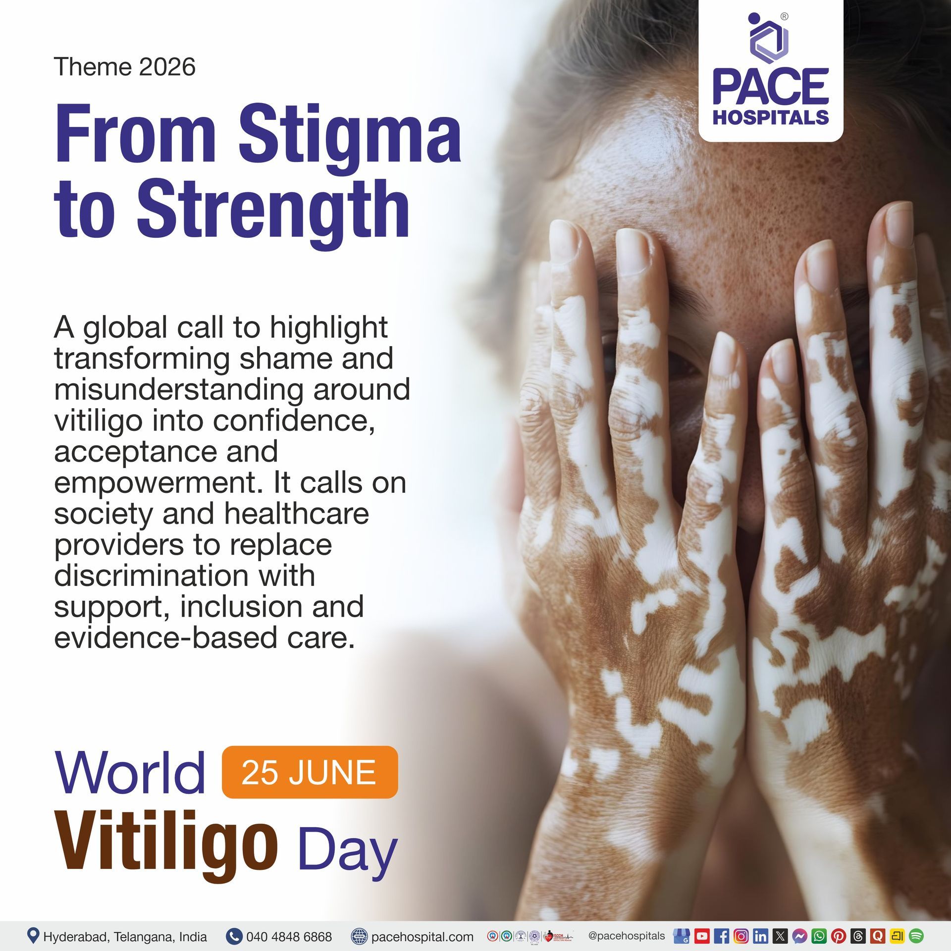 World Vitiligo Day 2026 Theme | Theme of World Vitiligo Day 2026 | Vitiligo means | Visual narrating the Theme of World Vitiligo Day 2026 | What is the theme of World Vitiligo Day 2026