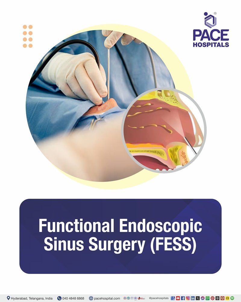FESS Surgery Cost in Hyderabad | Affordable Functional Endoscopic Sinus Surgery in India