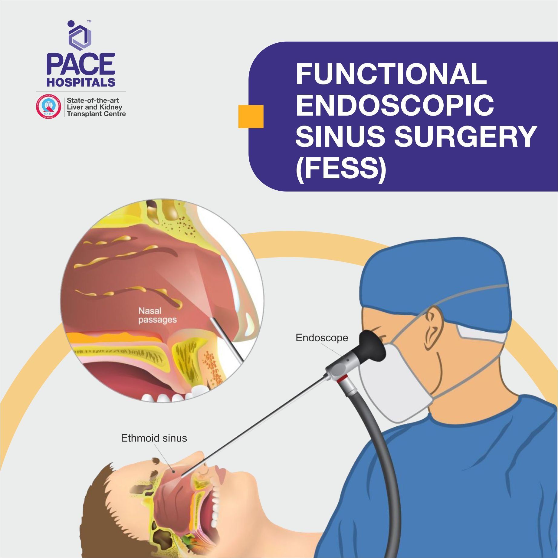 Functional endoscopic sinus surgery FESS in Hyderabad, Telangana, India Functional endoscopic sinus surgery FESS in Hyderabad, Telangana, India