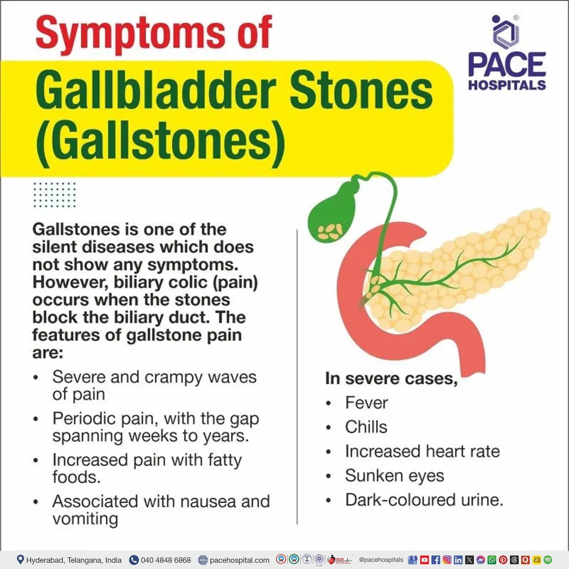 symptoms of gallbladder stone or gallstone gallbladder stone symptoms | gallbladder stone pain symptoms | gallstones symptoms in female and male | gall stone symptoms | gallstone pain symptoms