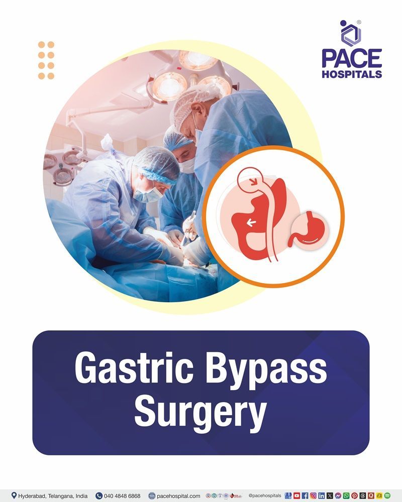 Gastric Bypass Surgery Cost in Hyderabad | Affordable Gastric Bypass Surgery in India