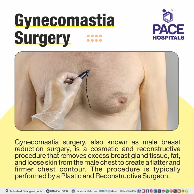 What is Gynecomastia Surgery? Gynecomastia surgery | what is gynecomastia | Male breast reduction surgery