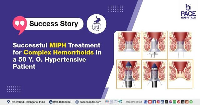 bpc 157 hemorrhoids Efficacy of Ruiyun procedure for combined simplified MilliganMorgan hemorrhoidectomy with dentate line-sparing in treating grade III/IV hemorrhoids: a retrospective study | BMC Surgery Frontiers | Stable Gastric Pentadecapeptide