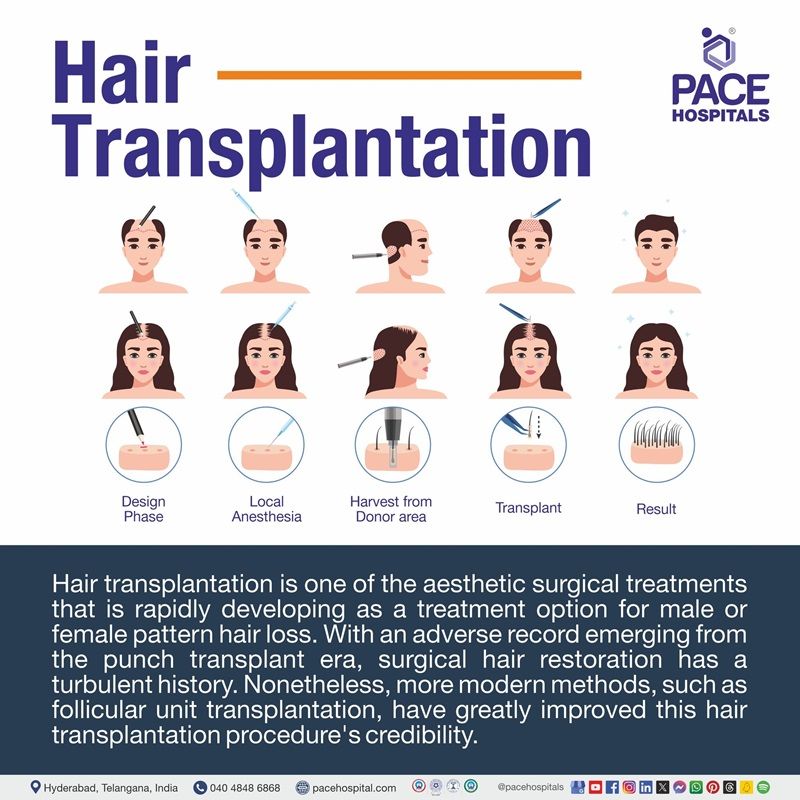 Hair Transplant meaning Best Hospital for hair transplant in Hyderabad India | hair transplant surgery hospital in Hyderabad | hair transplant near me | hair transplant cost in Hyderabad