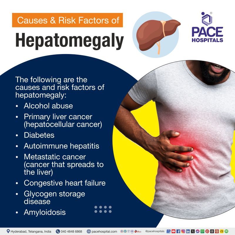 Hepatomegaly Causes and Risk Factors Hepatomegaly Causes | Risk Factors of Hepatomegaly | Causes of Hepatomegaly