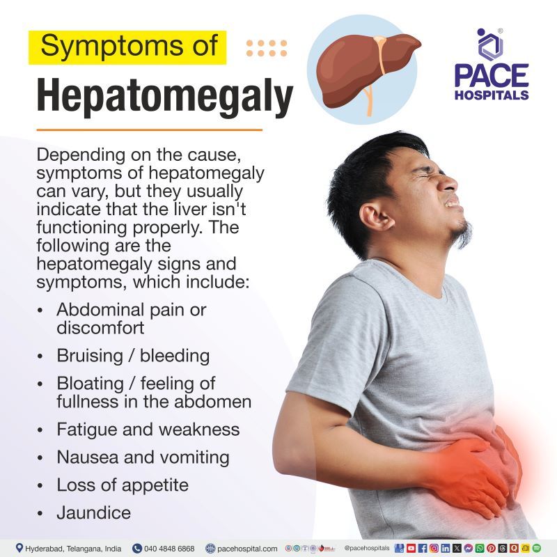 Hepatomegaly Symptoms Hepatomegaly Symptoms | Hepatomegaly signs and symptoms | Mild hepatomegaly symptoms