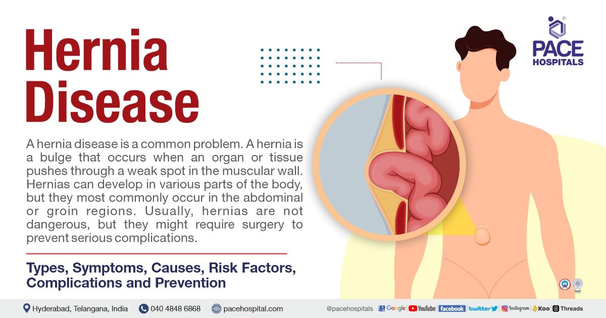 Hernia - Types, Symptoms, Causes, Risk Factors, Complications and Prevention