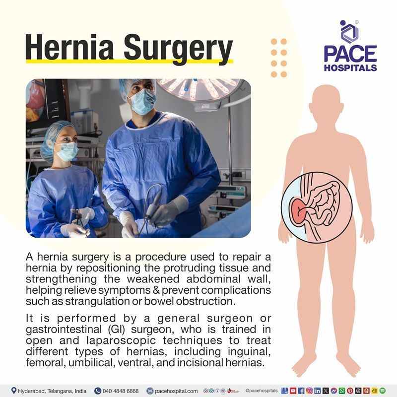 What is hernia surgery | Visual depicting the meaning of Hernia surgery