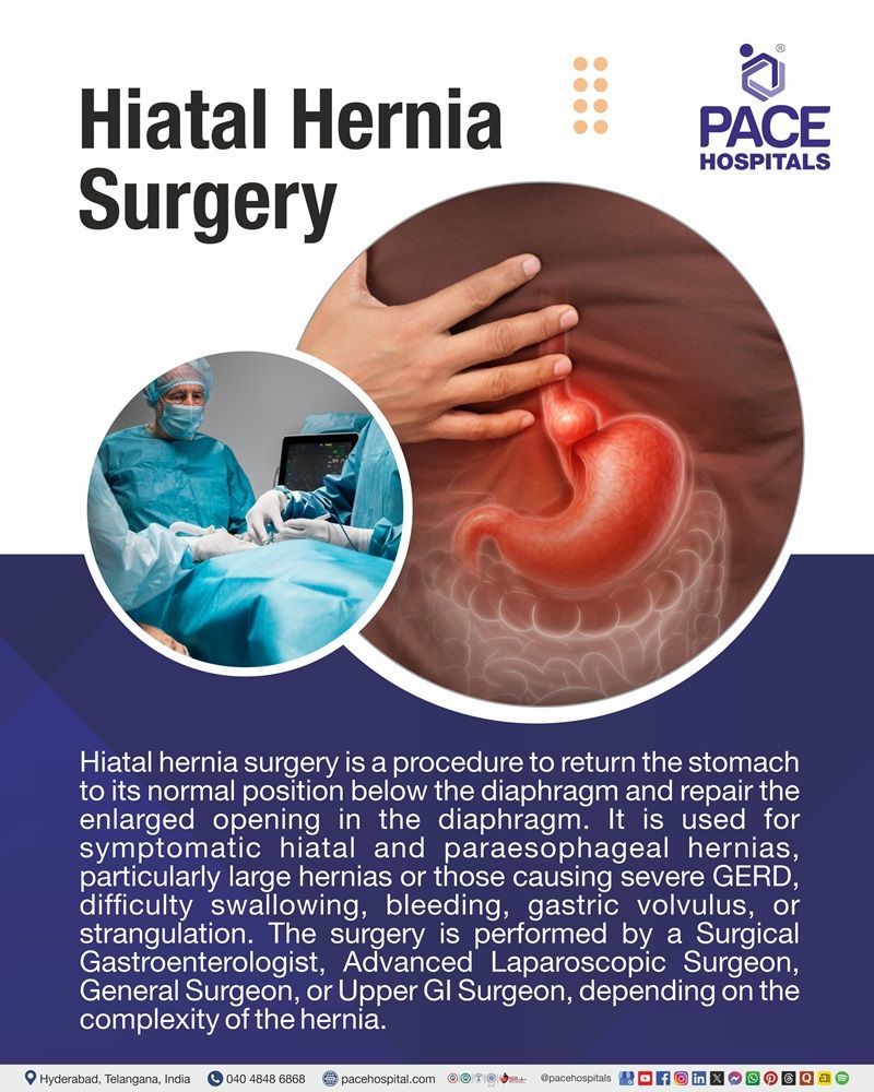 Hiatal Hernia Surgery Meaning Hiatal hernia surgery with illustrations of the abdominal bulge, hernia anatomy, and surgical repair options.