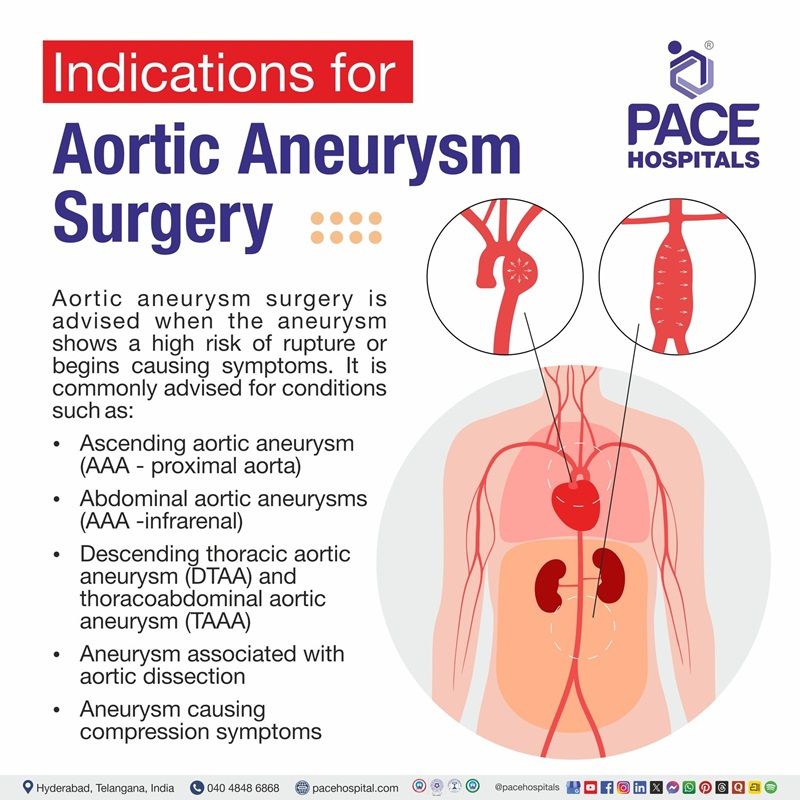 Aortic aneurysm surgery Indications Aortic aneurysm surgery indications | Visual depicting the indications of surgery in aortic aneurysm