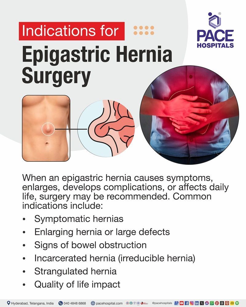 Epigastric Hernia Surgery Indications Common reasons for epigastric hernia surgery, including symptoms, enlargement, bowel obstruction, incarceration, strangulation, and quality of life impact.