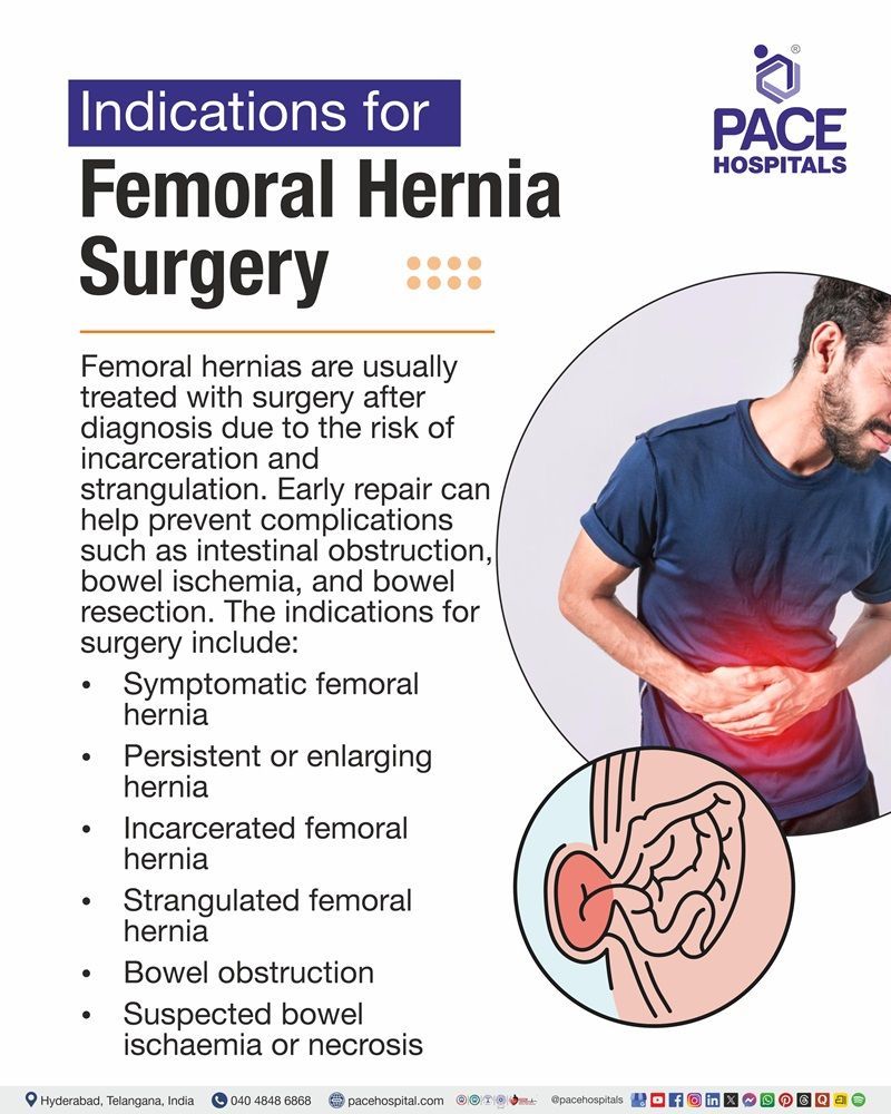 Indications for Femoral Hernia Surgery Image depicting the Indications for femoral hernia surgery including symptomatic, enlarging, incarcerated or strangulated femoral hernia
