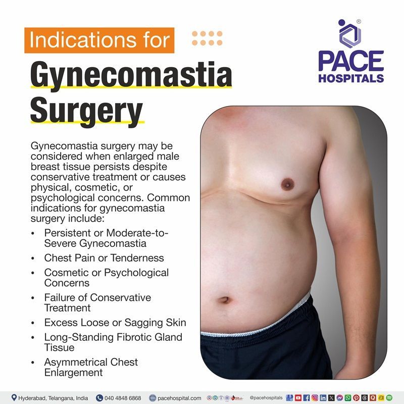 Indications of Gynecomastia Surgery image depicting the signs and circumstances of Gynecomastia Surgery | Gynecomastia Surgery indications