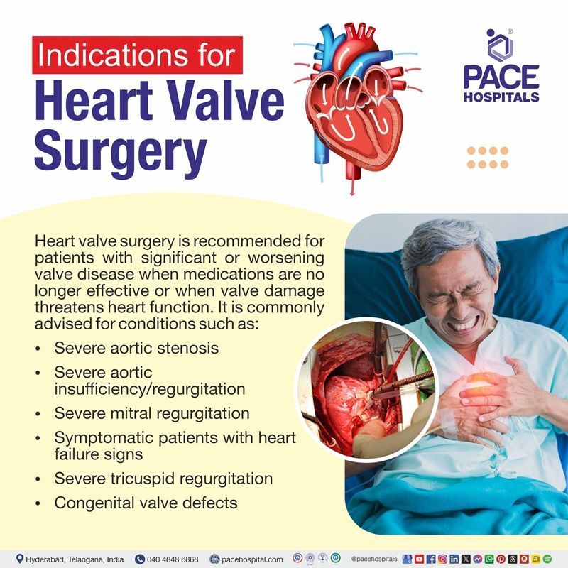 Indications of Heart Valve Surgery Indications of Heart Valve Replacement Surgery in Hyderabad, India