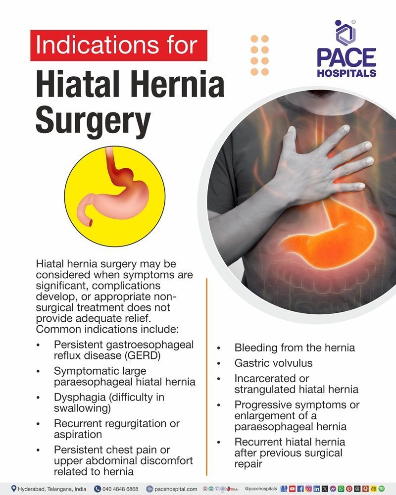 Hiatal Hernia Surgery Indications Indications for hiatal hernia surgery, including persistent GERD, dysphagia, bleeding, and gastric volvulus.