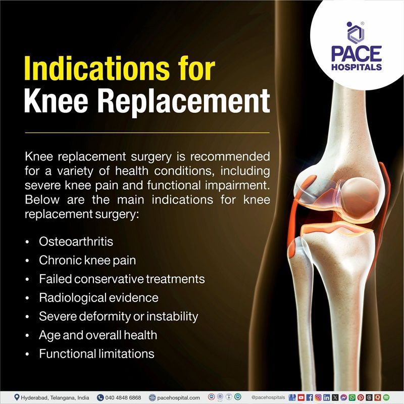 Indications for Knee Replacement Surgery Indications for Knee Replacement Surgery | Knee Joint Replacement Surgery in Hyderabad, Telangana, India