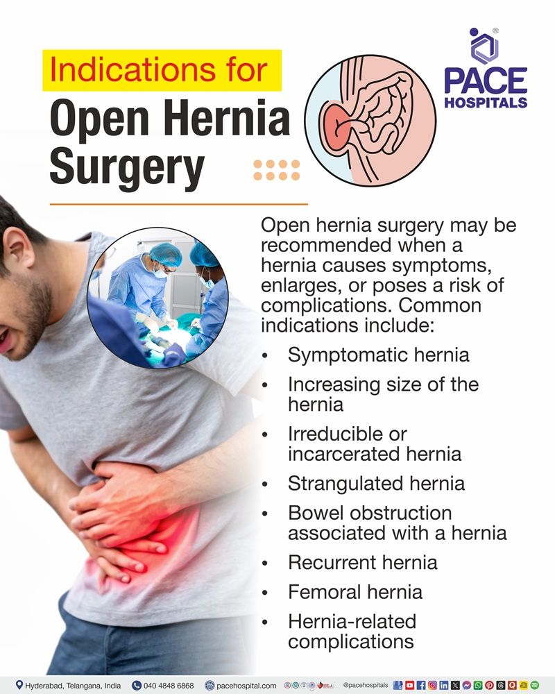 Indications of Open Hernia Surgery Situations where open hernia surgery may be recommended, including symptomatic, enlarging, incarcerated, strangulated, recurrent, or complicated hernias.