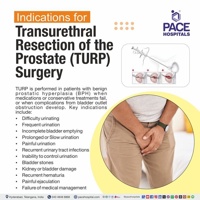 Indications of TURP Surgery Indications of TURP Surgery | Visual depicting the indications of TURP Surgery