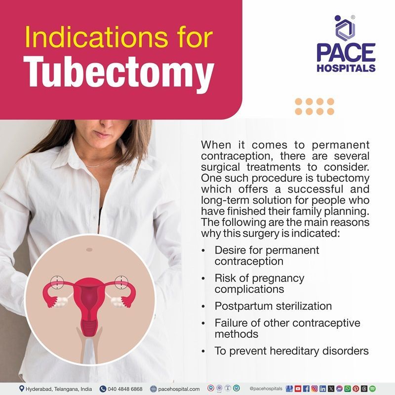Indications for Tubectomy (Tubal Ligation) Surgery Indications for Tubectomy Operation | Tubal Ligation Surgery Indications