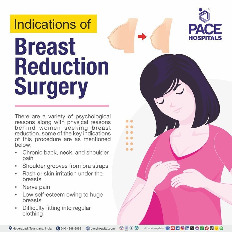 Indications of Breast reduction surgery Breast reduction surgery indications | Indications for Breast reduction surgery | physical reasons behind breast reduction surgery | Visual showing the indications of breast reduction surgery