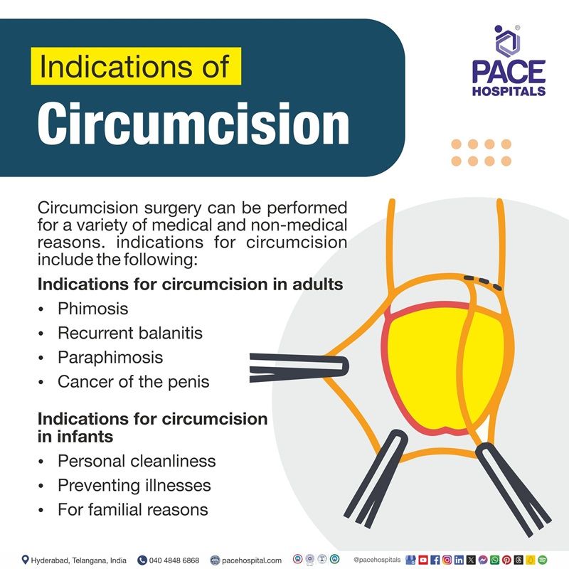 Circumcision indications indications of circumcision | indications for circumcision | ZSR and laser circumcision near me | best hospitals for circumcision in Hyderabad India
