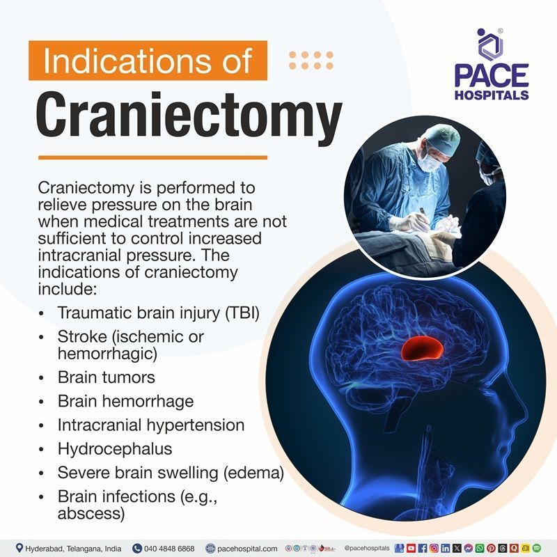 Visual depictijg the indications of craniectomy | illustration showing the signs for craniectomy surgery