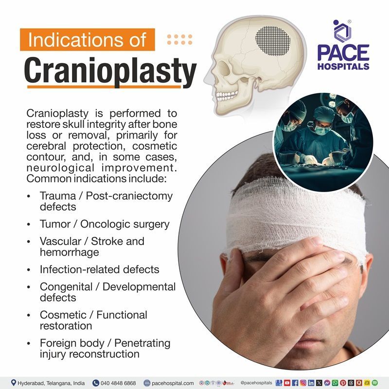 Indications of Cranioplasty Visual depictijg the indications of Cranioplasty | medical illustration showing the signs for Cranioplasty surgery