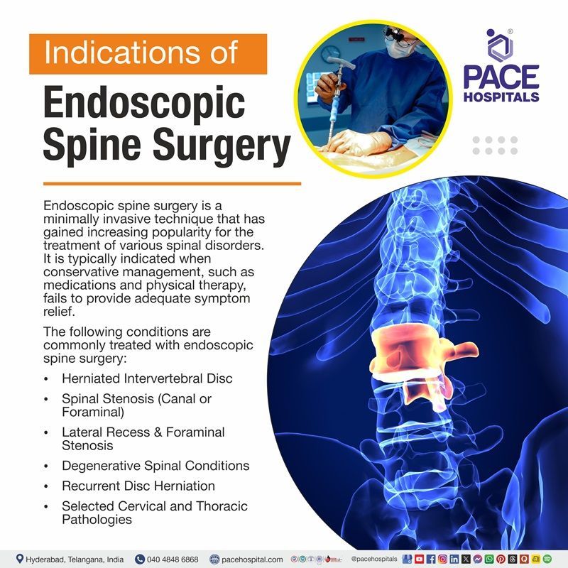 Indications of Endoscopic Spine Surgery Endoscopic spine surgery indications with highlighted lumbar disc image | indications Endoscopic spine surgery