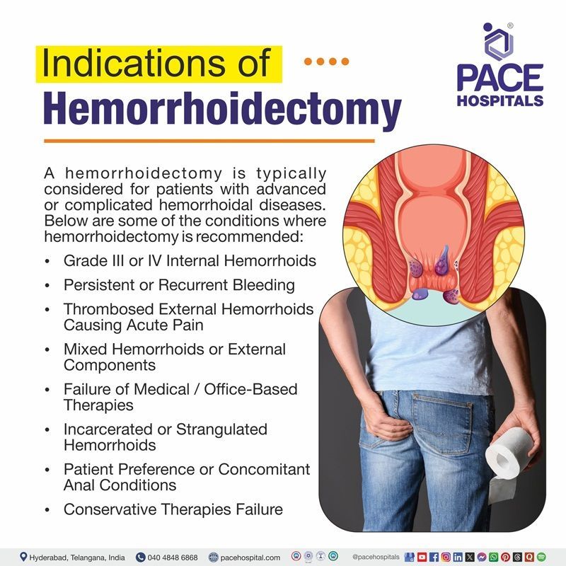 Indications of Hemorrhoidectomy hemorrhoidectomy indications | indications of hemorrhoidectomy | What are the indications of hemorrhoidectomy