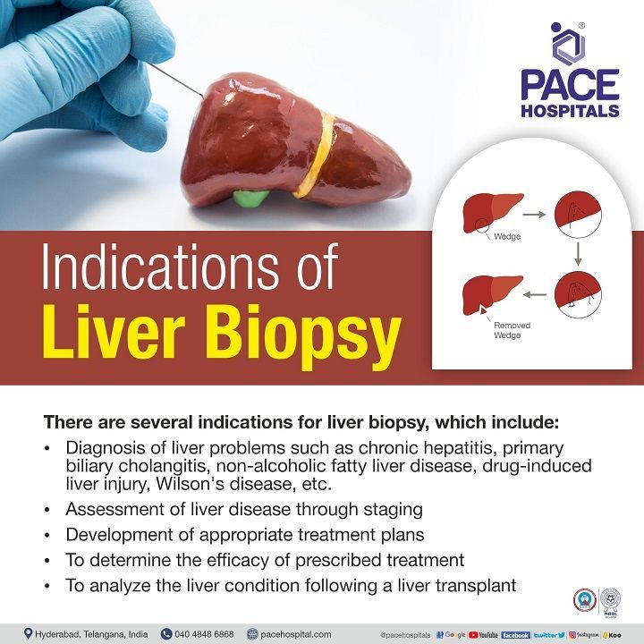 liver biopsy test liver biopsy indications | liver biopsy test in hyderabad, india