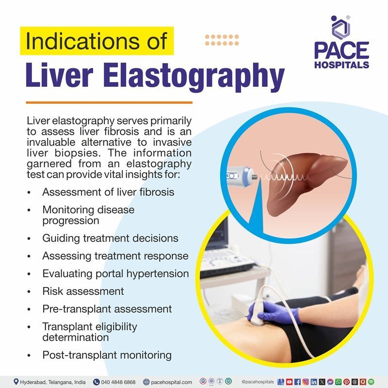 Indications of Liver Elastography | Liver Elastography Indications