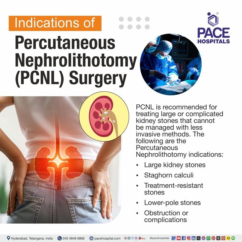 When PCNL is recommended for kidney stone treatment infographic | PCNL Surgery indications