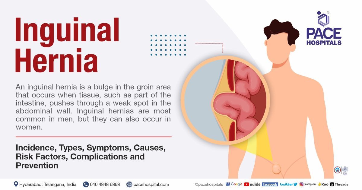 Inguinal Hernia - Signs & Symptoms, Types, Causes, Risk Factors, Complications and Prevention
