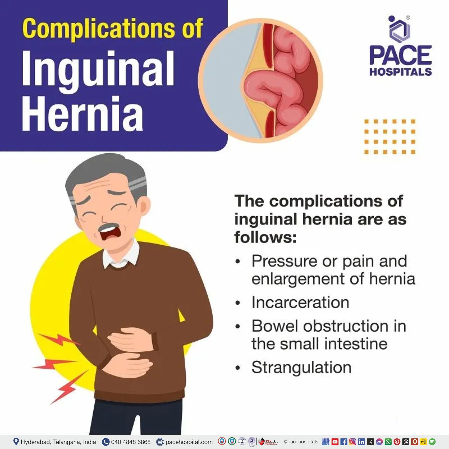 inguinal hernia complications if not treated | uncomplicated inguinal hernia | complications of direct inguinal hernia