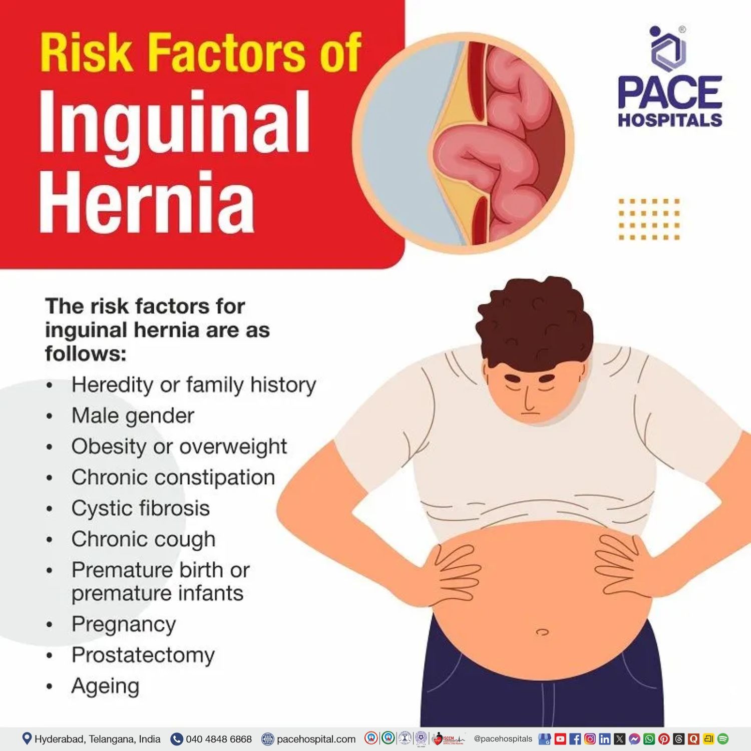 inguinal hernia risk factors | inguinal hernia risks | inguinal hernia risk of strangulation