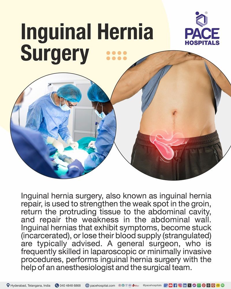 Visual depicting Inguinal hernia surgery to repair the abdominal wall and return protruding tissue to its normal position.