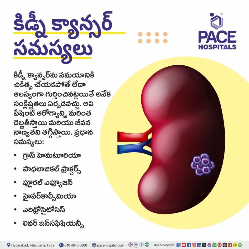 కిడ్నీ క్యాన్సర్ సమస్యలు | Kidney Cancer Complications in Telugu Kidney Cancer Complications in Telugu | కిడ్నీ క్యాన్సర్ సమస్యలు | Complications of Kidney Cancer in Telugu