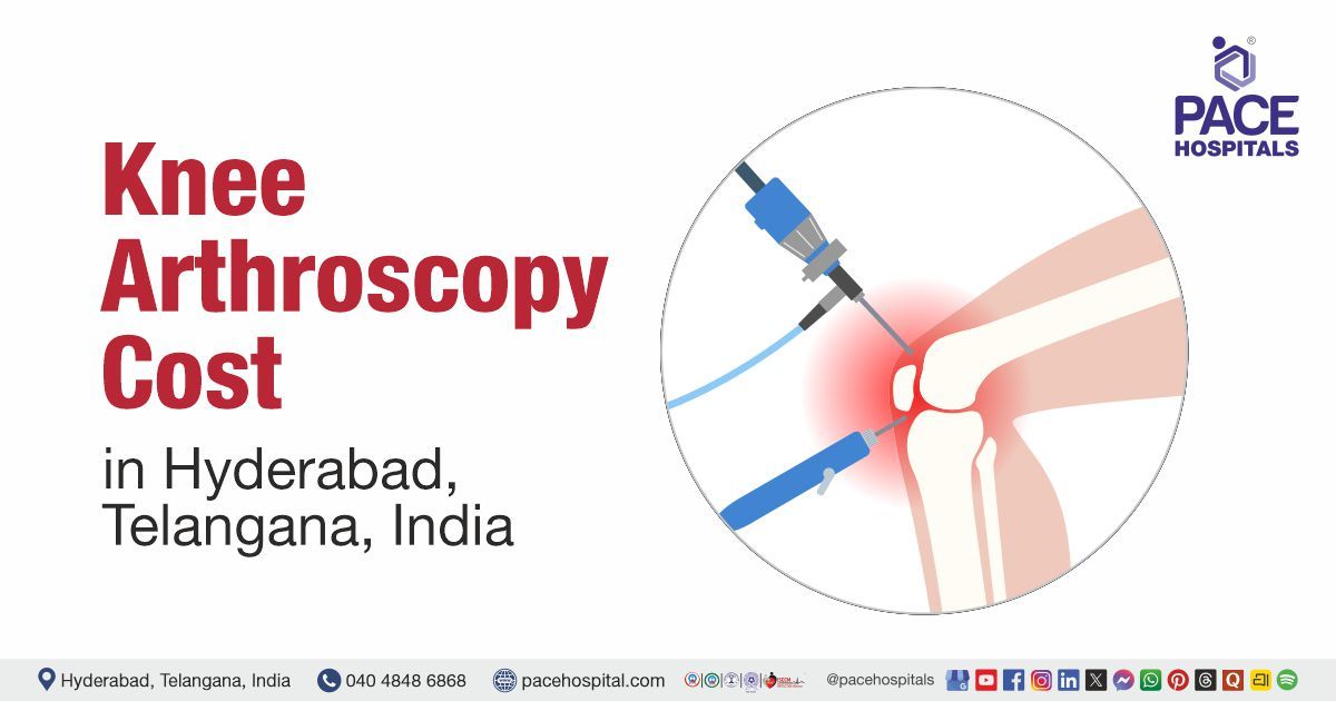cost of knee arthroscopy in Hyderabad at PACE Hospitals. knee arthroscopy cost estimate