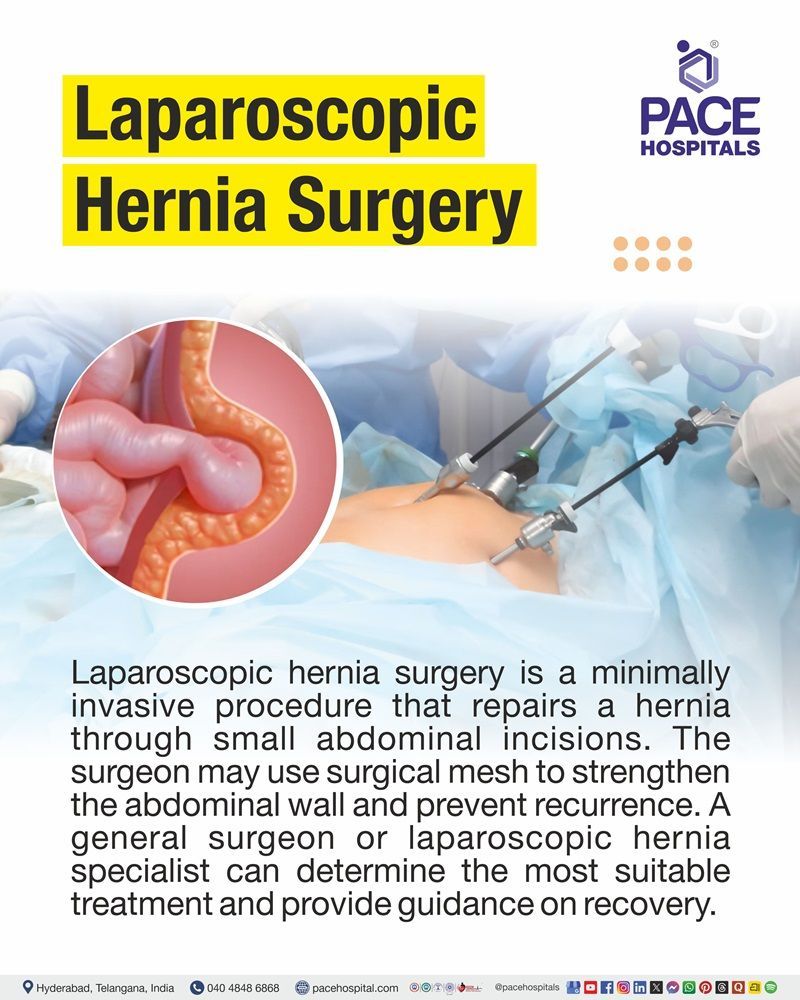 Laparoscopic Hernia Surgery Meaning Laparoscopic hernia surgery uses small abdominal incisions and specialized instruments, with mesh often used to reinforce the abdominal wall.