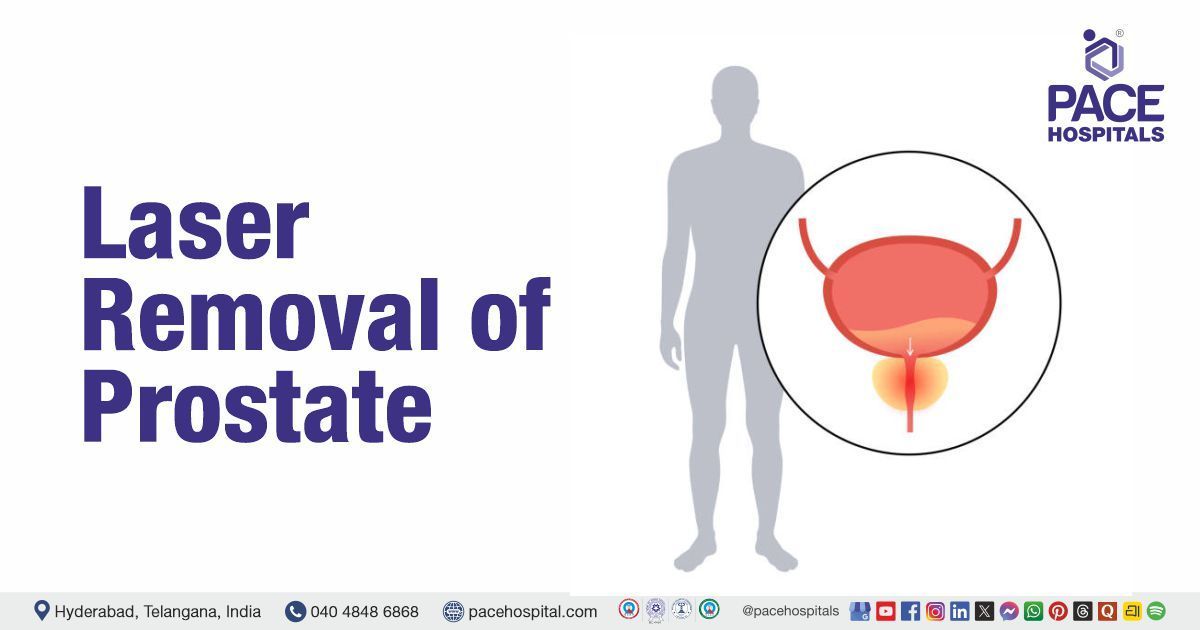 Laser removal of prostate - HoLEP (Holmium Laser Enucleation of the Prostate)