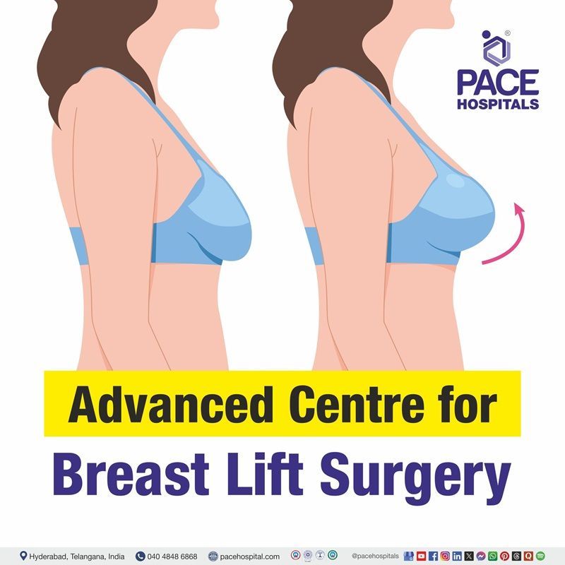 Leading Centre for Breast lift surgery in Hyderabad, India Best hospital for breast lift surgery in Hyderabad | breast lift surgery before and after