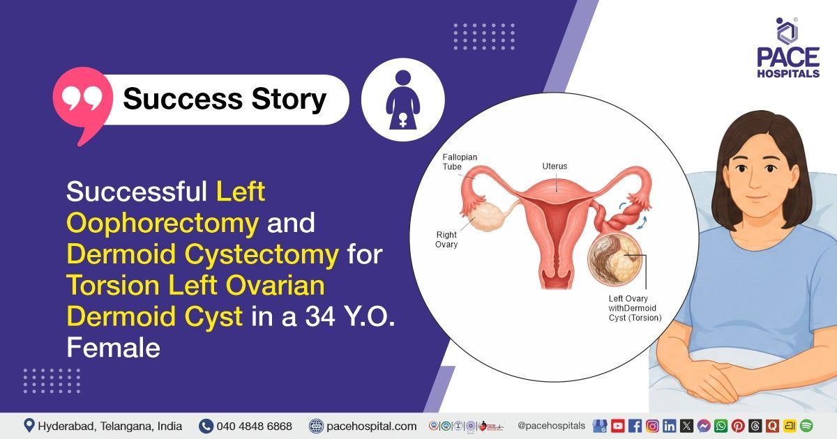 Torsion Ovarian Dermoid Cyst treated successfully with Oophorectomy & Cystectomy at PACE Hospitals
