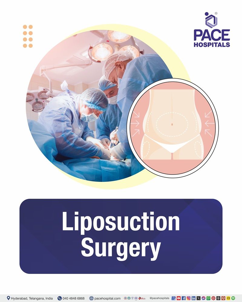 Liposuction Surgery Cost in Hyderabad | Affordable Liposuction in India
