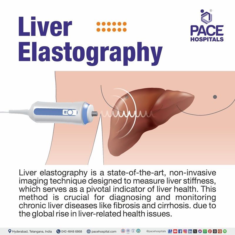 Best hospital for Liver Elastography in Hyderabad India Best hospital for Liver Elastography in Hyderabad | Fibroscan in Telangana India
