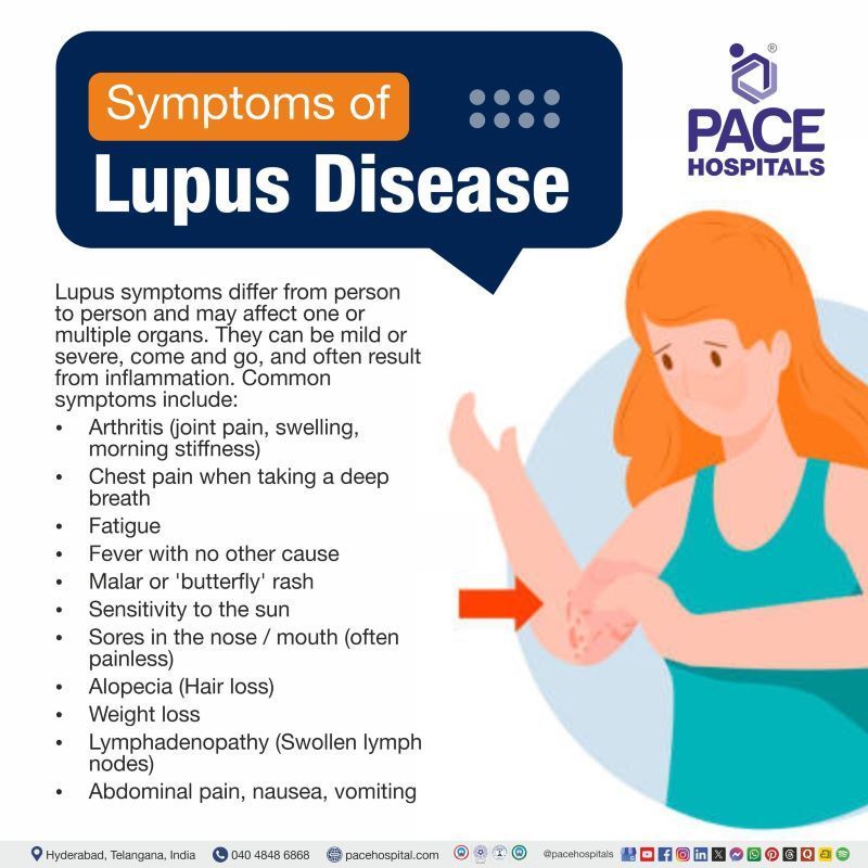 Lupus Symptoms Lupus Symptoms | Lupus symptoms women | Early lupus symptoms