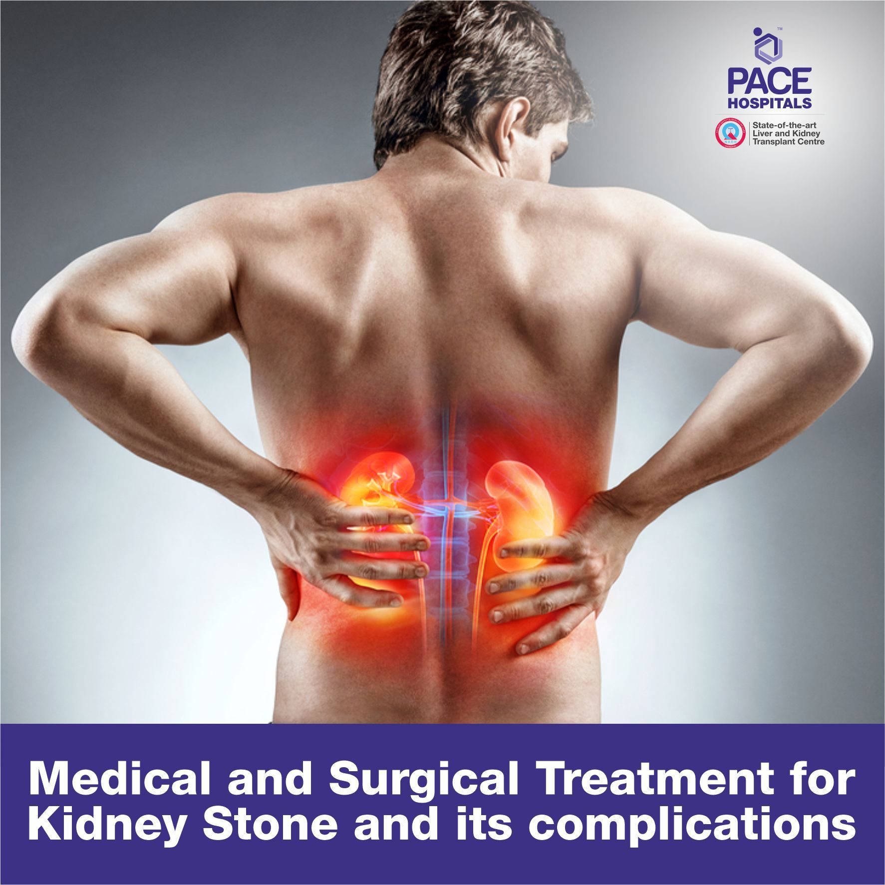 Medical and Surgical Treatment for Kidney Stone and its complications Medical and Surgical Treatment for Kidney Stone and its complications