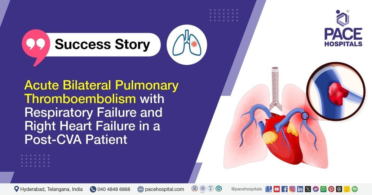 Successful Management of Acute Pulmonary Thromboembolism with Right Heart Failure at PACE Hospitals